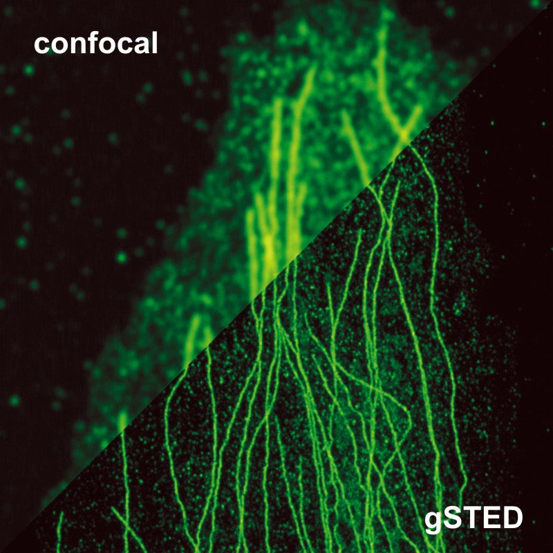 STED image of Tubulin in comparison to a standard confocal image