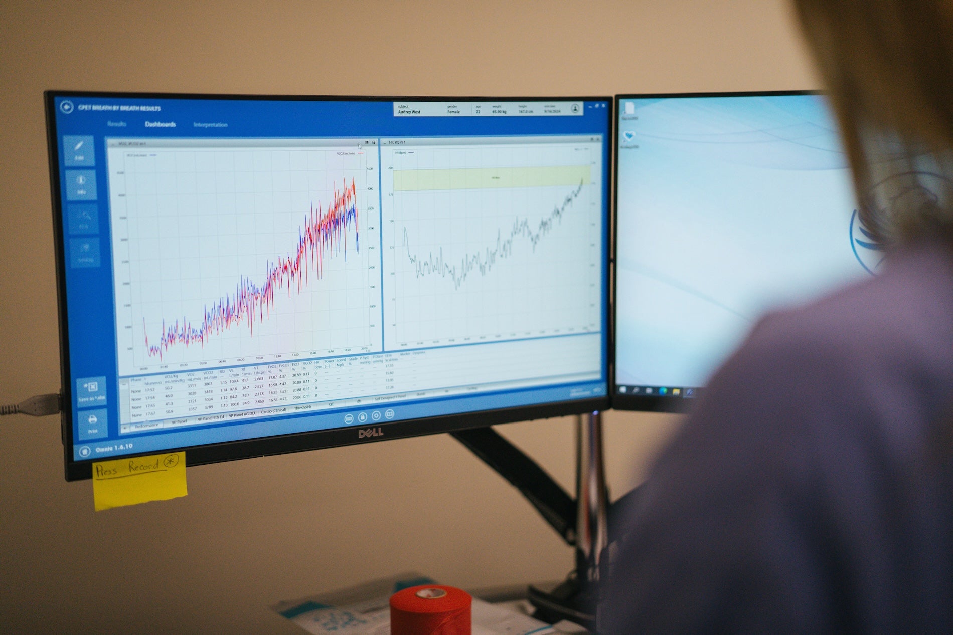 screen of a report during an exercise evaluation