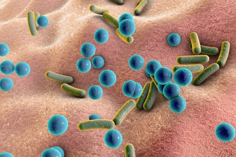 Rod-shaped and spherical bacteria on skin or mucous membrane, Escherichia coli, Salmonella, Klebsiella, Mycobacterium tuberculosis, Legionella, Pseudomonas, Staphylococcus, Streptococcus, other cocci